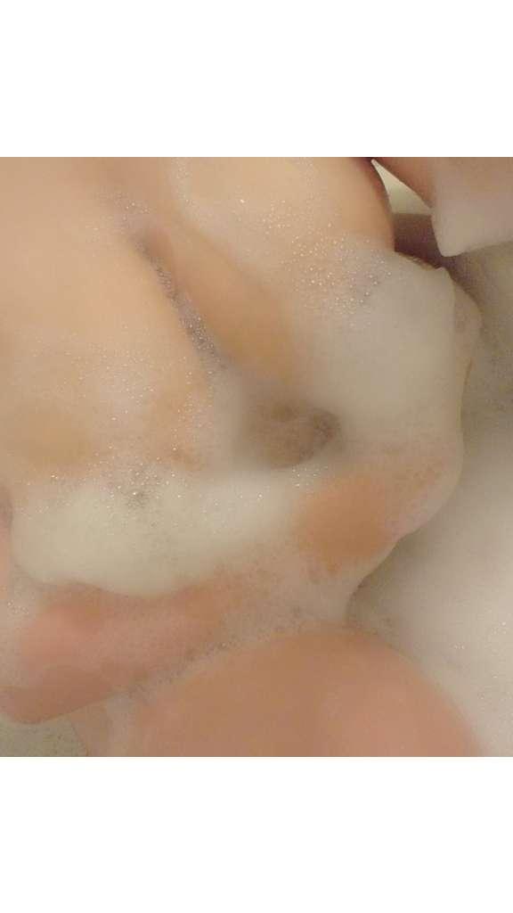 急遽