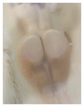 もう✧少しで…