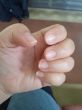 爪がボロボロ(´；ω；｀)？