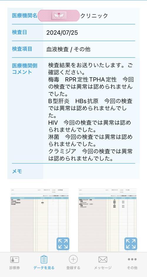 性病検査