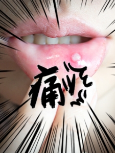 口内〇〇のアイキャッチ画像