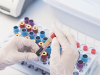 ホットポイントグループで働くメリット4