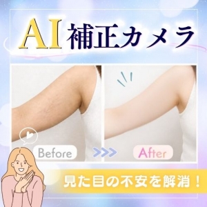 【AI補正カメラ】で顔も身体もまるごとカバー♪のアイキャッチ画像