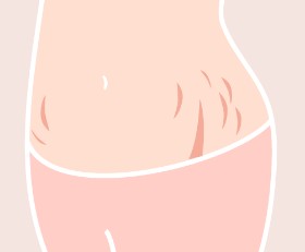 目立つ傷跡がある場合、 働くことは難しい？のアイキャッチ画像